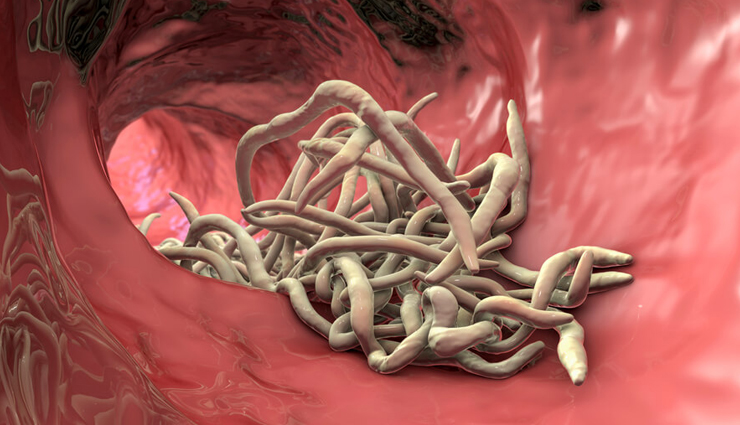 irritability in children,treat irritability in children,home remedies to treat irritability in children,children care,children care tips,Health,Health tips