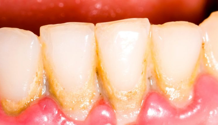 aloe vera,aloe vera health benefits,aloe vera healthy food,healthy food aloe vera,Health,healthy tips,healthy food