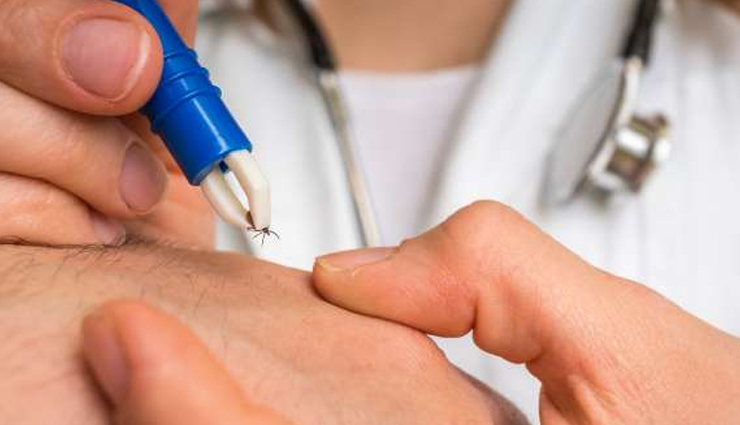 plums,beauty benefits of plums,beauty tips,skin care tips