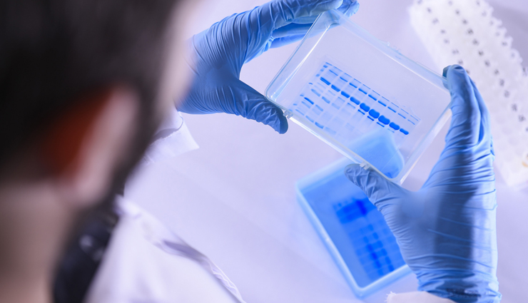 plums,beauty benefits of plums,beauty tips,skin care tips