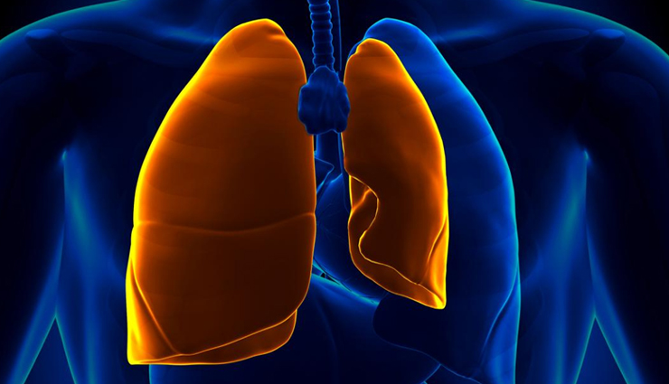 What is Pneumothorax? 5 Effective Remedies To Treat Pneumothorax