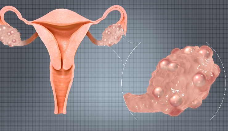 women reproductive health issues,common female health concerns,reproductive system problems in women,women health disorders,common gynecological issues,female reproductive health conditions,reproductive health challenges women,major women health concerns,female reproductive disorders,women health problems list