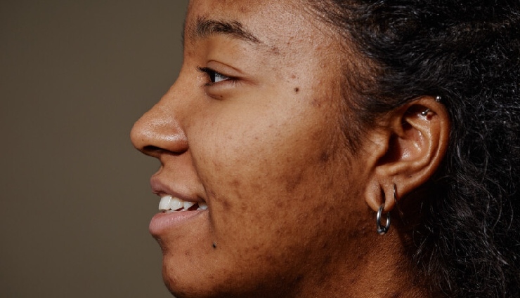 balanced diet importance,protein deficiency effects,essential nutrients for health,protein and immunity,healthy diet tips,nutrients for body functions,vitamins and minerals,healthy eating habits,protein rich foods,nutrition and wellness