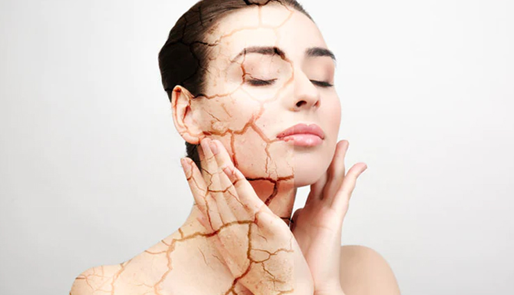 7 Major of Signs Of Poor Skin Hydration