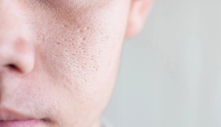 skin toner benefits,what is skin toner,natural skin toner,rose water toner,toner for oily skin,toner for acne-prone skin,how to use toner,herbal skin toner,ayurvedic toner,skin care routine toner,facial toner advantages