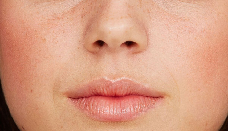 6 DIY Ways To Get Rid of Pores From Skin