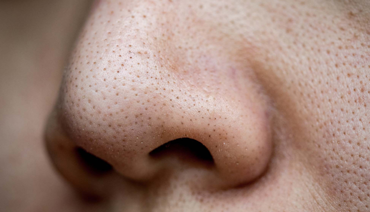 home remedies to get rid of pores,large pores,open pores,remedies to get rid of open pores,beauty tips,beauty hacks,remedies to treat open pores