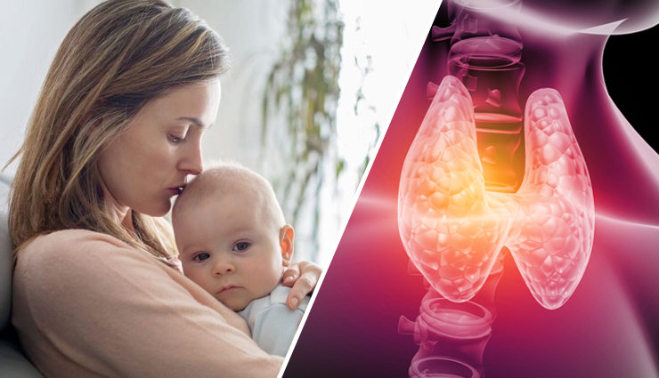 What is Postpartum Thyroiditis? Key Symptoms and Treatment