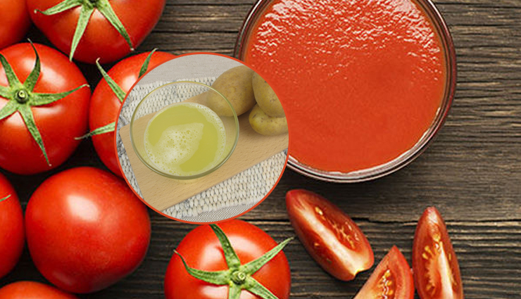 tanning from back,tips to get rid of tanning,back tanning,beauty,beauty tips,tanning,home remedies to get rid of tanning