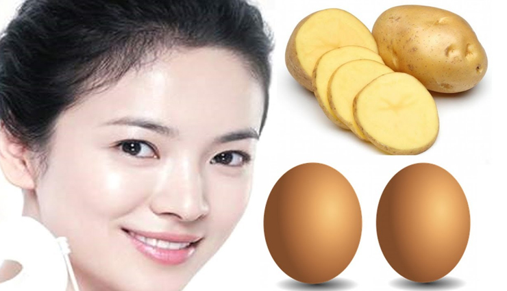 diy ways to get rid of eye puffiness,eye puffiness,beauty tips,beauty hacks,treating eye puffiness