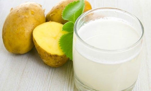 stretch marks,home remedies for stretch marks,beauty,beauty tips