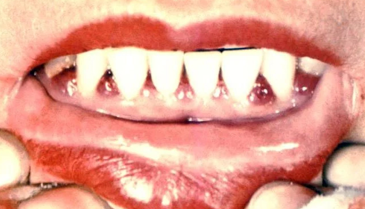 Potatoes,health benefits of eating potatoes,Health tips,fitness tips