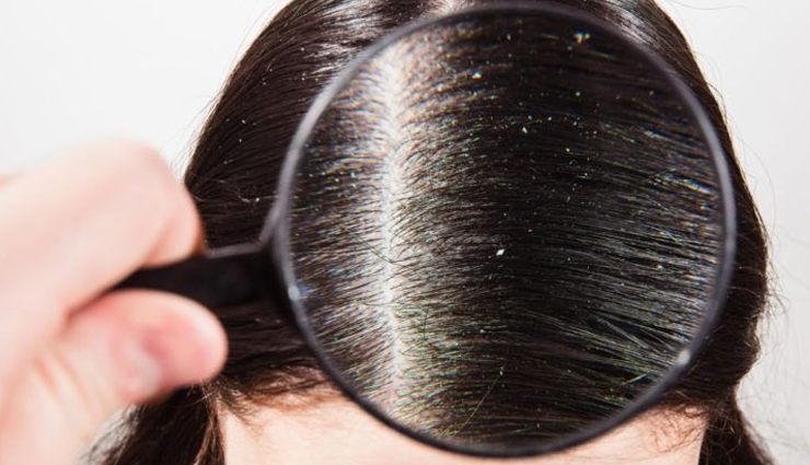 apple cider vinegar,beauty benefits of apple cider vinegar,beauty tips,skin care tips