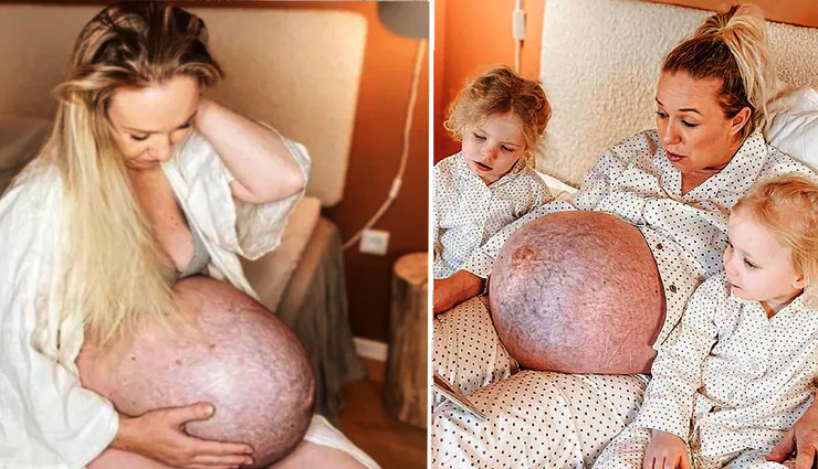 OMG! इस प्रेग्नेंट महिला का पेट देखकर हर कोई रह गया हैरान