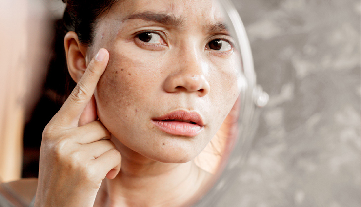 10 beauty benefits,black tea,black tea benefits,beauty benefits of black tea,black tea beauty benefits,beauty,beauty benefits