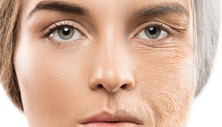 stress and beauty,impact of stress on physical appearance,surprising effects of stress on beauty,beauty problems caused by stress,mental health and beauty,stress and skin problems,hair loss due to stress,dark circles caused by stress,stress and acne,how stress affects your appearance