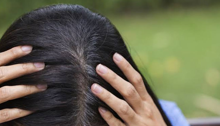 premature graying of hair,remedies to treat premature graying of hair,hair care tips,beauty tips,home remedies