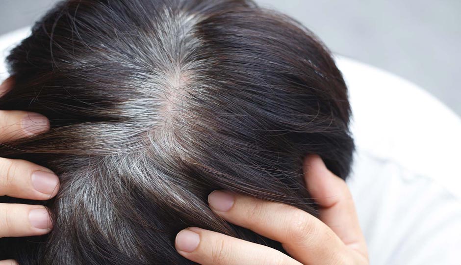 7 DIY Ways To Treat Premature Greying of Hair