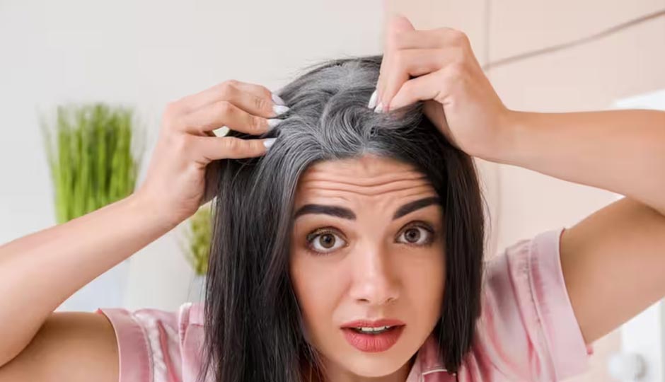 8 Home Remedies to Treat Premature Greying of Hair