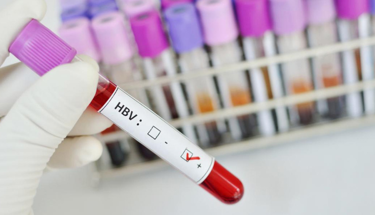 prevent hepatitis b,hepatitis b