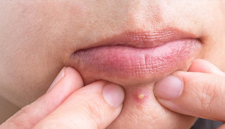 sandalwood,sandalwood for glowing skin,benefits of sandalwood for glowing skin,beauty benefits of sandalwood for glowing skin,beauty,skin care tips,beauty tips,quick beauty tips