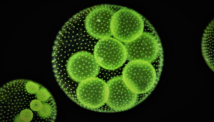 probiotic foods,healthy food,Health tips,fitness tips