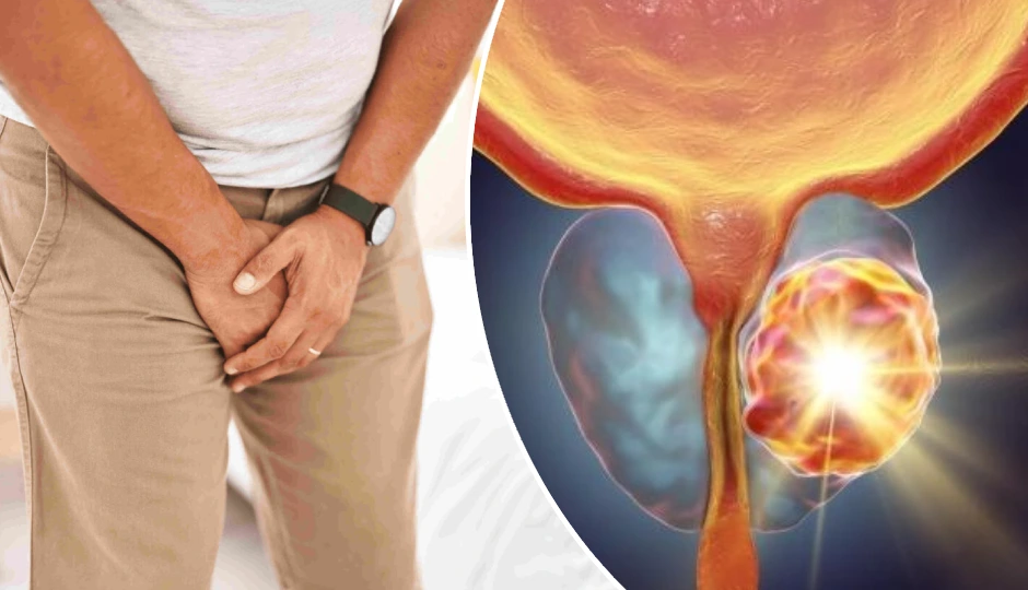 14 Foods That Increases and Reduces The Chances of Prostate Cancer