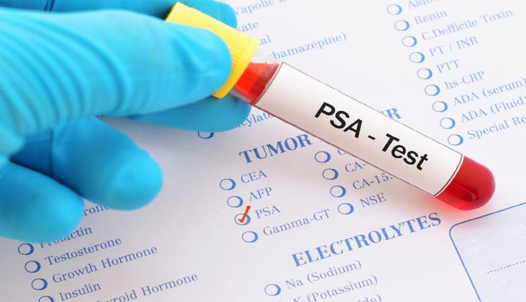 इन 5 बीमारियों का समय रहते करा लें स्क्रीनिंग टेस्ट, कहीं देर ना हो जाए Health tips,health tips in hindi,disease screening test,healthy life