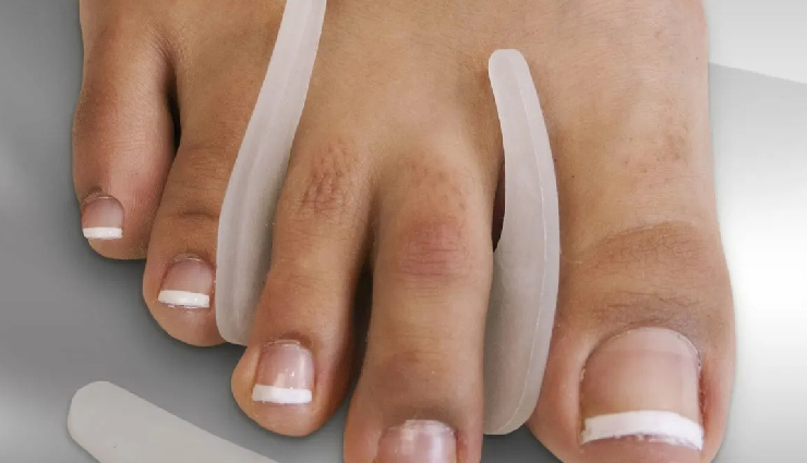 corns and calluses,corns and calluses treatment,symptoms of corns,symptoms of calluses,causes of corns,causes of calluses,how to treat corns,how to treat calluses,home remedies for corns,home remedies for calluses