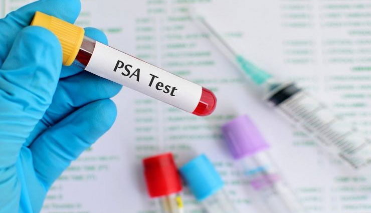 live healthy,medical check ups,dental check up,blood test,cholesterol test,psa test,diabetes test