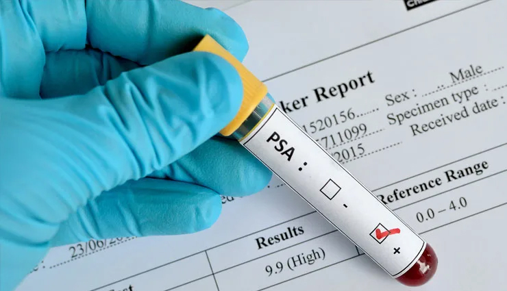 यूरीनेशन से जुड़े इन लक्षणों को नजरअंदाज करना हो सकता हैं पुरुषों के लिए घातक, जानें इसके बारे में urinary tract infection in males,male uti symptoms,treatment for male urine infection,causes of urinary infections in men,uti prevention tips for males,male urinary health issues,signs of urine infection in men,remedies for male uti,male bladder infection,managing urinary tract infections in males,prevention and treatment of male utis,male urinary system health,uti awareness for men,male urological health tips,urinary infection in men symptoms