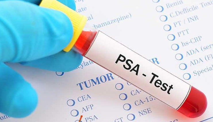 Father's Day 2022: अगर बनाना चाहते हैं फादर्स डे को कुछ खास, तो पिता को दें सेहत का ये उपहार fathers day,fathers day 2022,fathers day celebration,medical test father,Health,Health tips,health news