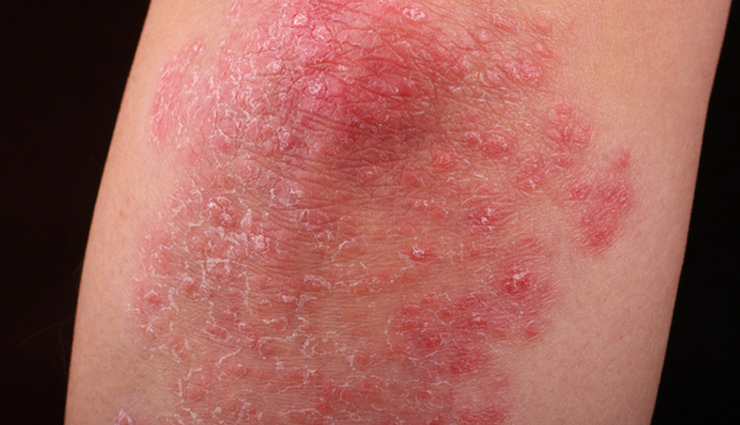 केले से ज्यादा फायदेमंद है उसका छिलका, 10 ऐसे फायदे जो आपको रखेंगे हमेशा तरोताजा banana,banana peel,health benefits of banana peel,banana peel for good health,banana peel for beauty,banana peel benefits