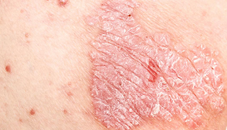 sandalwood,beauty benefits of sandalwood,sandalwood for skin,skin care tips,skin beauty,beauty tips,fair skin tips,how to apply sandalwood on skin