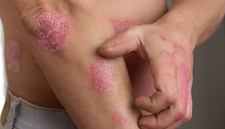 almond oil skincare benefits,benefits of using almond oil for skin,almond oil for radiant skin,nourishing skin with almond oil,almond oil impact on skincare,natural skincare benefits of almond oil,almond oil for healthy and glowing skin,rejuvenating your skin with almond oil,incorporating almond oil into your skincare routine,discover the magic of almond oil for skin