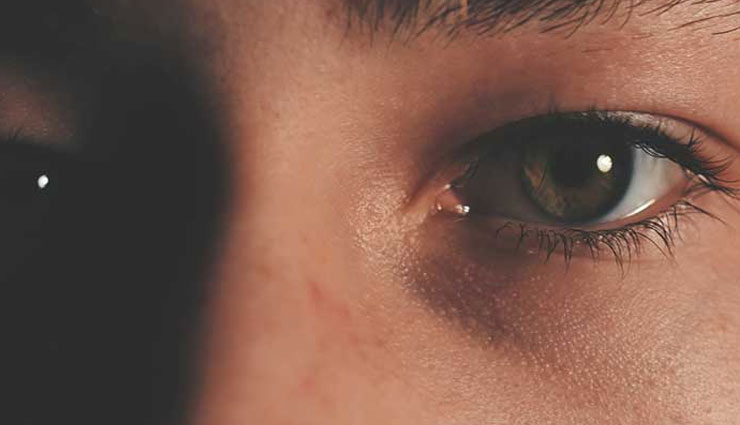 puffiness across eyes,remedies to reduce puffiness across eyes,eyes care tips,beauty tips,home remedies