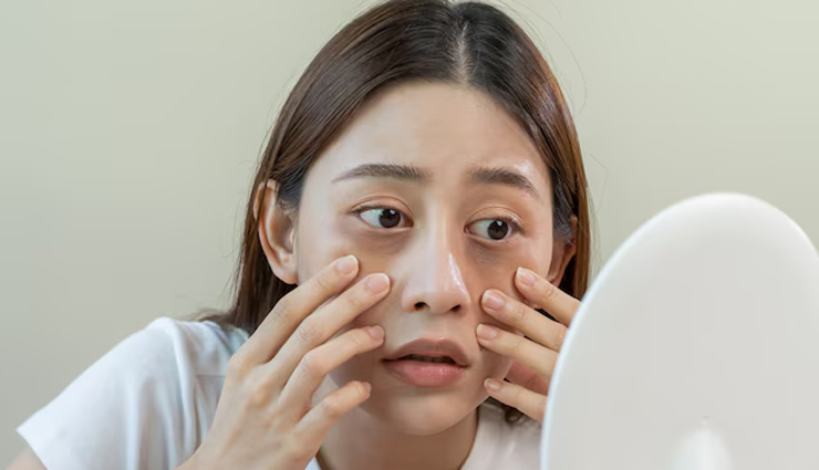 witch hazel skin benefits,skincare with witch hazel,reduce puffiness,combat acne with witch hazel,heal bruises naturally,minimize open pores,treat varicose veins,soothe sunburn,affordable skincare solutions,witch hazel oil benefits