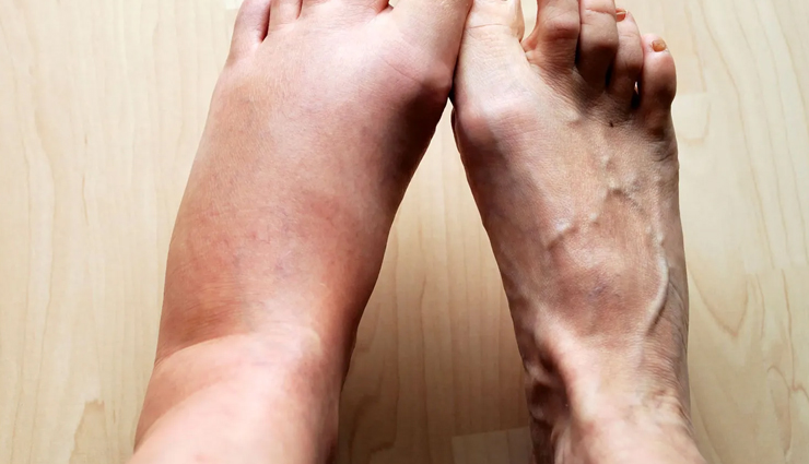 punarnava,health benefits of punarnava,Health tips,fitness tips