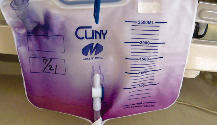 urine color,meaning of urine color,urine,Health,Health tips