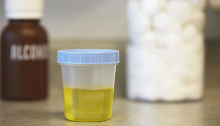 10 Home Remedies o Get Rid of Excess Pus Cells in Urine