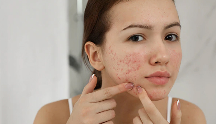 putrajeevak health benefits,putranjiva roxburghii properties,lucky bean tree advantages,medicinal uses of putraveeji,health benefits you did not know,nutritional value of putrajeevak,putranjiva roxburghii health impact,traditional uses of lucky bean tree,lesser-known health benefits,putrajeevak for well-being