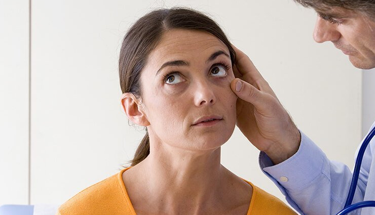 quenepas fruit,health benefits of quenepas fruit,Health tips,fitness tips