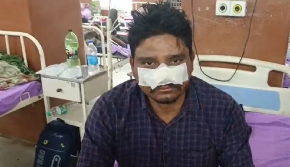 राजस्थान में सनसनीखेज घटना: नाबालिग बेटे ने पिता पर किया खौफनाक हमला, दांतों से काटा प्राइवेट पार्ट और नाक