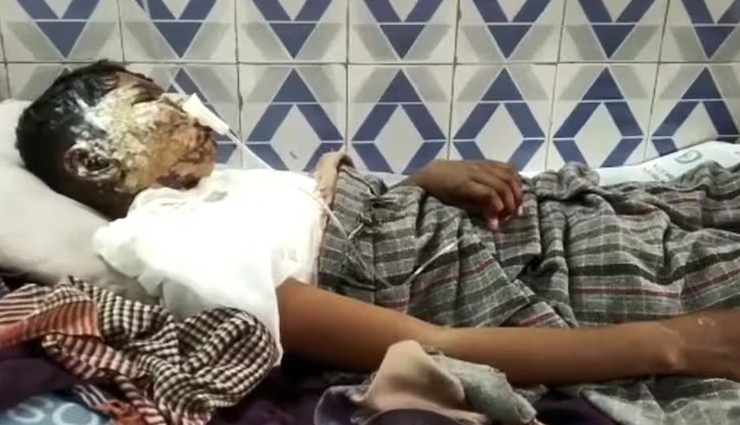 गुजरात : स्कूल में 14 साल के छात्र को पहले पीटा फिर दिया बिजली का झटका, बगीचा साफ करने से किया था मना