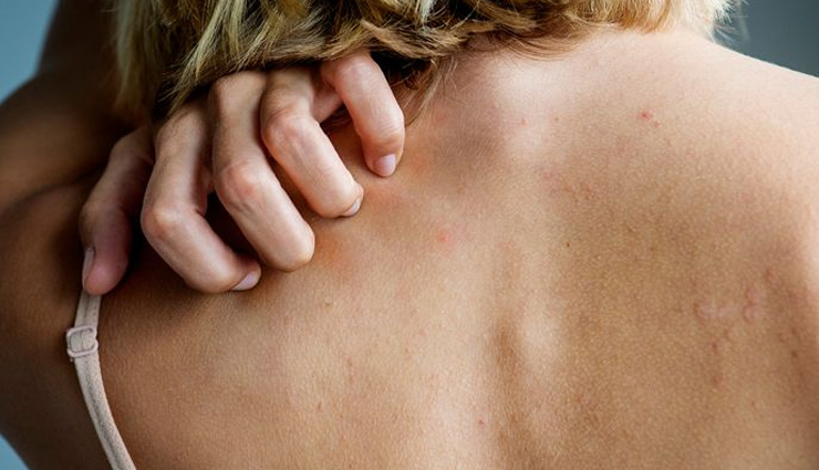 summer diseases prevention,avoiding common summer illnesses,health tips for summer diseases,summer health risks and prevention,protecting against summer diseases,stay healthy in summer,summer illness prevention strategies,common summer diseases to avoid,tips to prevent summer ailments,stay illness-free this summer