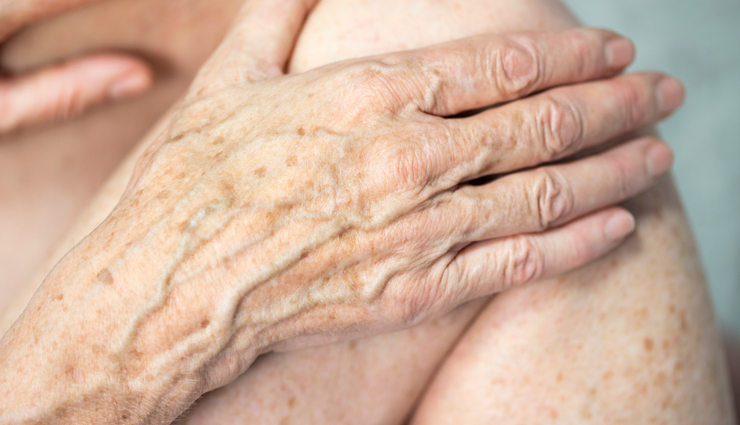 raspberry,health benefits of raspberry,Health tips,fitness tips