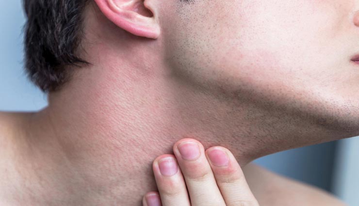 रेजर बर्न से रहते हैं परेशान, शेविंग के दौरान रखें इन बातों का ध्यान 