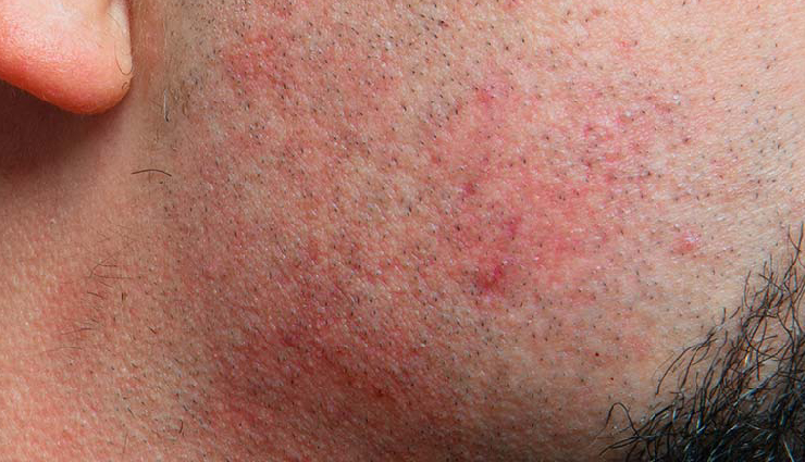 men grooming tips,grooming tips for men,personal hygiene for men,men skincare routine,haircare tips for men,nose hair trimming for men,nail care for men,body hair trimming for men,eyebrow grooming for men,men deodorant tips,razor burn treatment for men,lip care for men,men grooming essentials,male grooming advice,men grooming habits,tips for grooming men,male hygiene tips,men skincare advice,men grooming products,men beauty tips