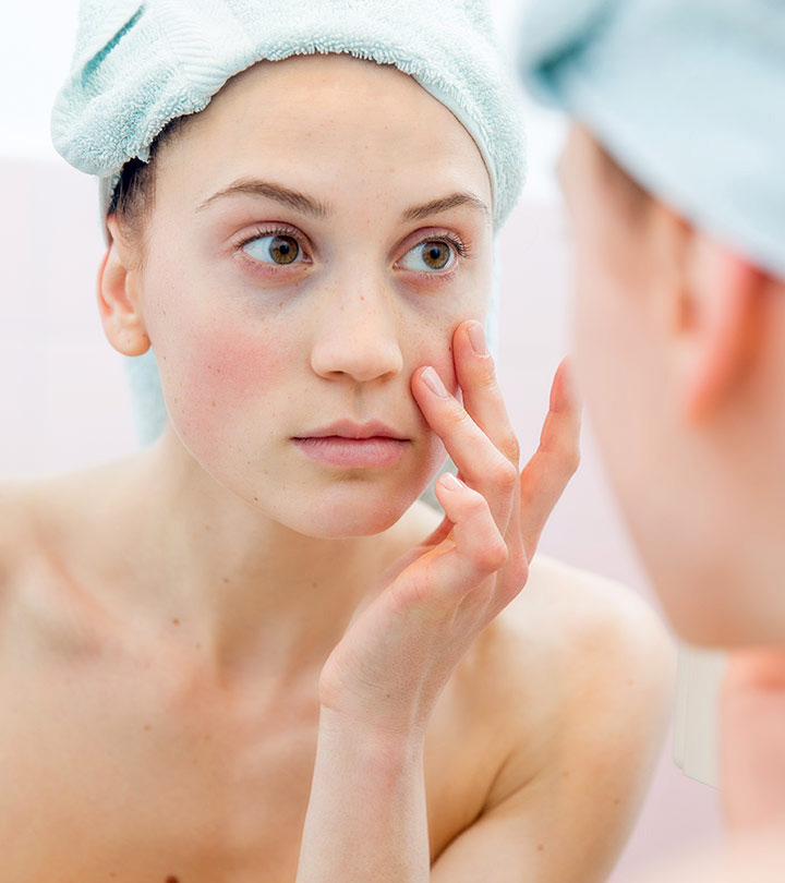 reasons behind dark circles,causes of dark circles,dark circles,beauty tips,skin care tips