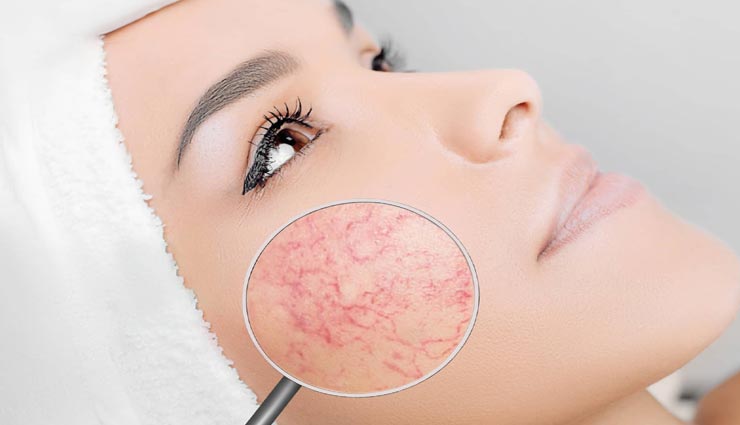 गालों का रंग देखकर पहचाने व्यक्ति का स्वभाव, इस तरह लगाएं पता astrology tips,astrology tips in hindi,nature by cheeks color